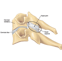 Facet Joint Injection