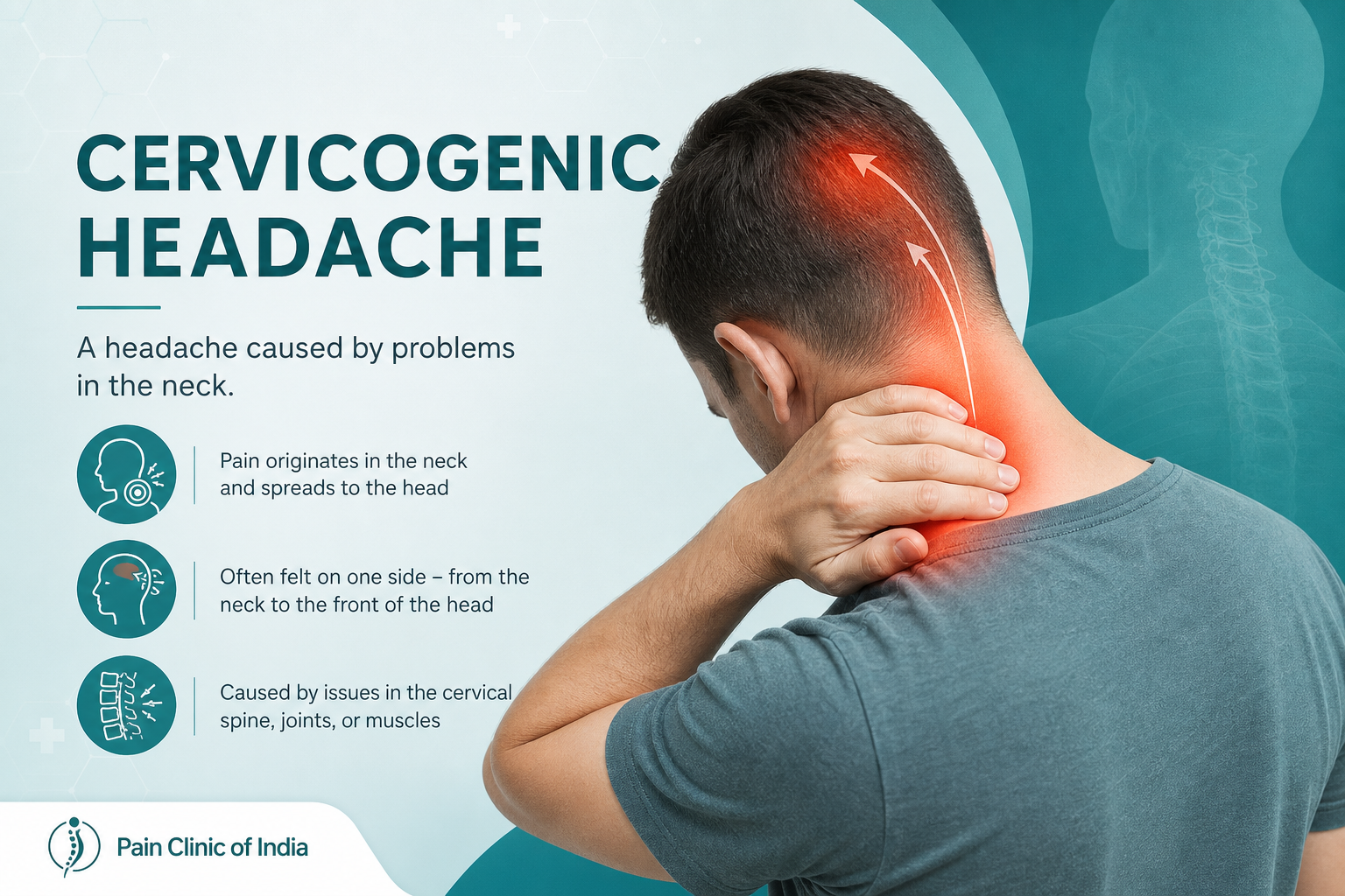 Cervicogenic headache caused by neck problems