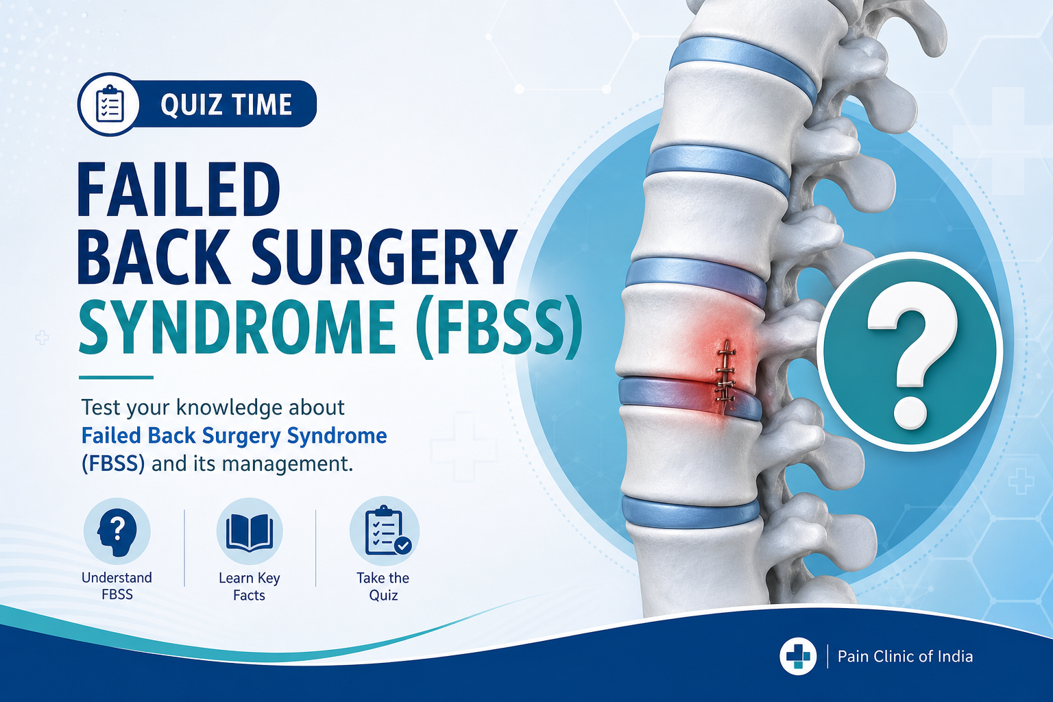 Failed Back Surgery Syndrome FBSS educational quiz
