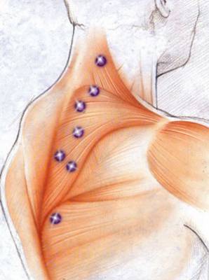 neck pain treatment