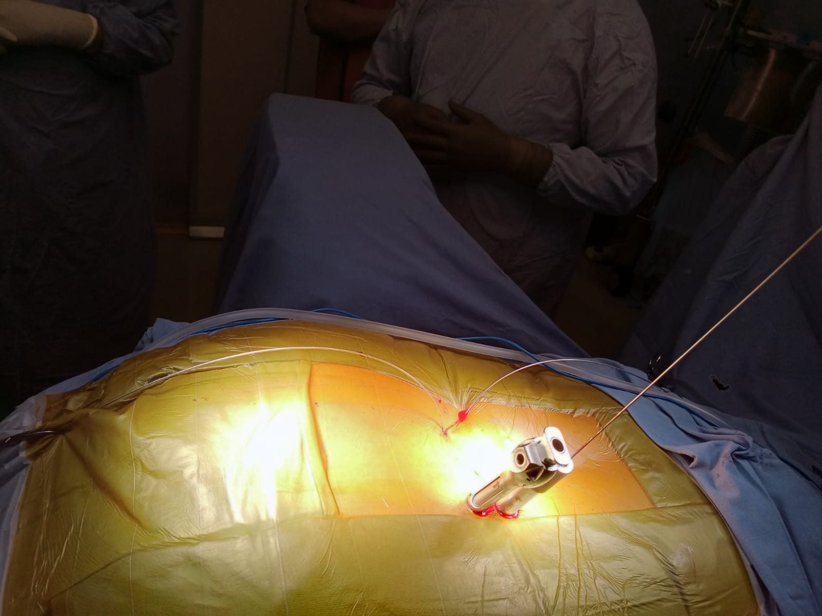 Interventional pain procedure being performed under focused lighting and imaging