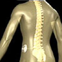 Intrathecal