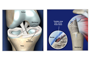 prolotherapy reference image