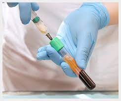 Collecting PRP