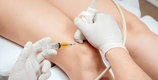 PRP injection