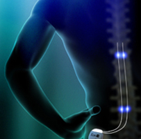 Spinal cord stimulation